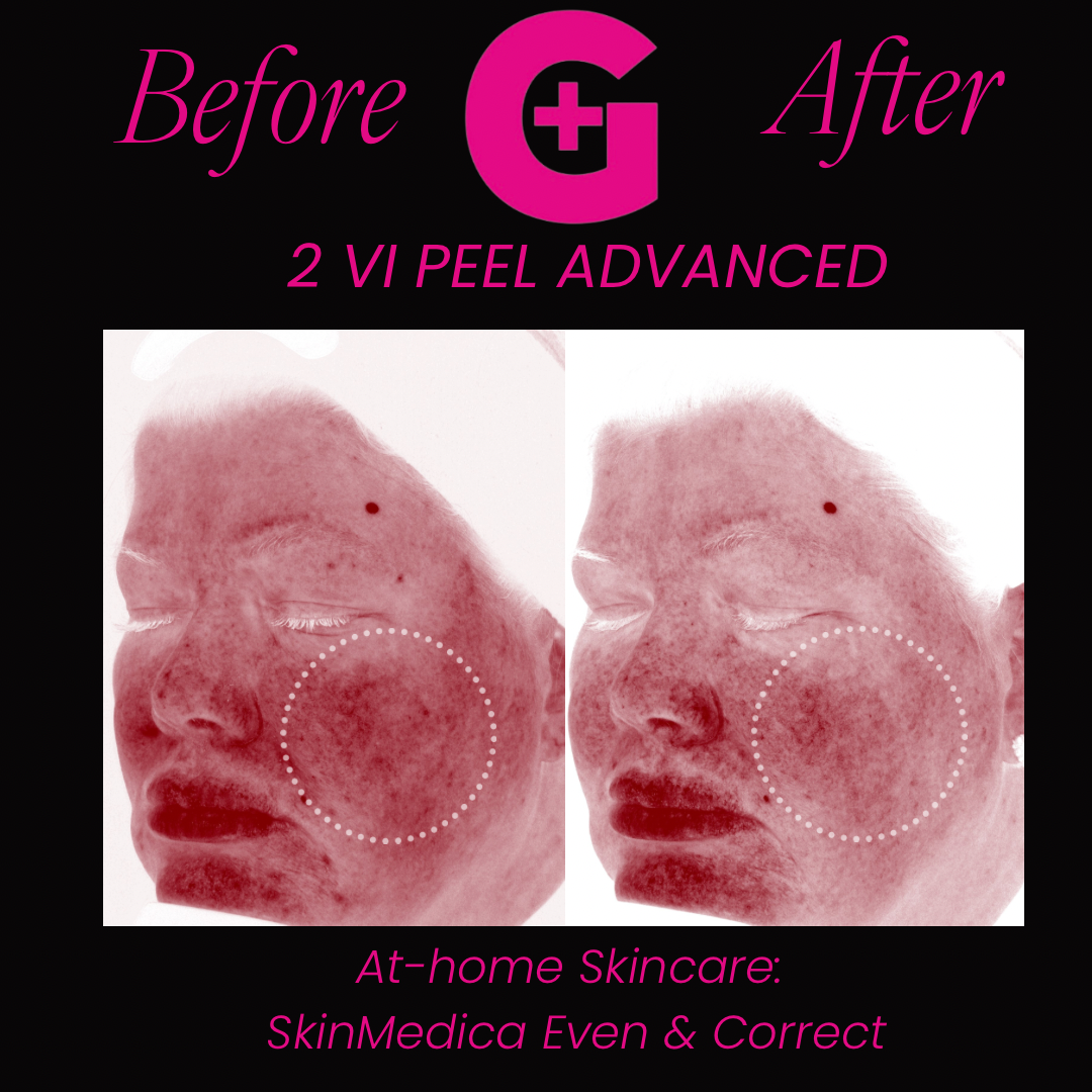 before and afters - 23